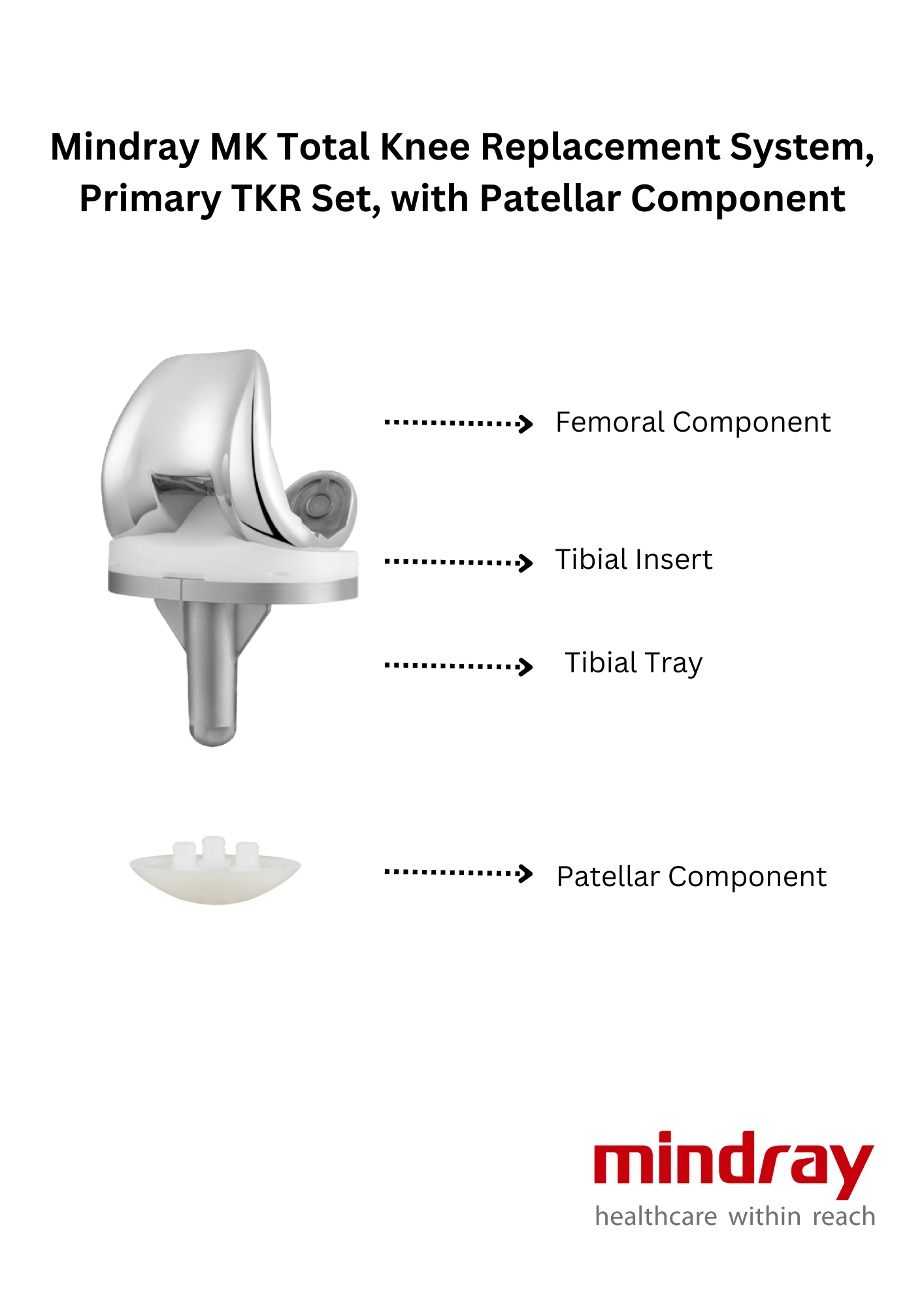 Mindray MK Total Knee Replacement System, Primary TKR, Arthroplasty Set with Patella