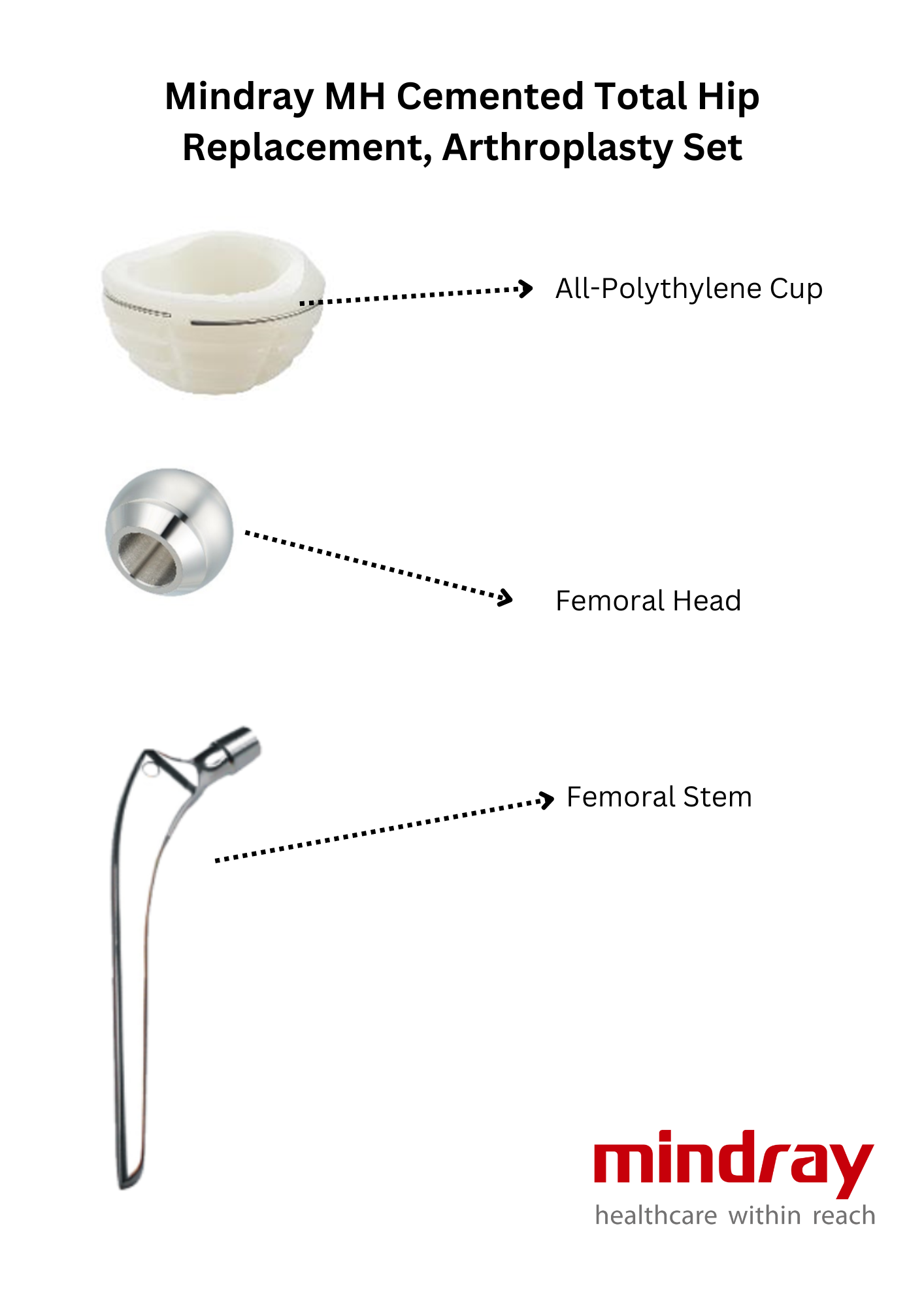 Mindray MH Cemented Total Hip Replacement, Arthroplasty Set