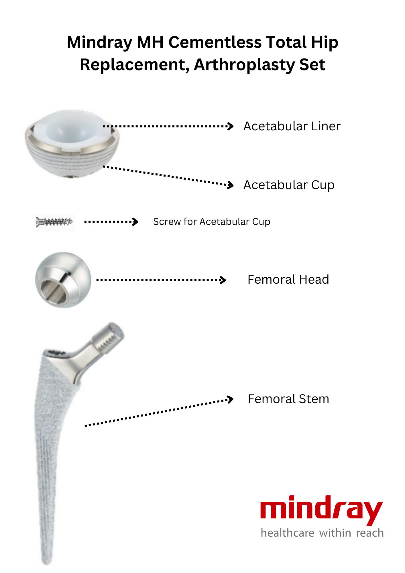 Mindray MH Cementless Total Hip Replacement, Arthroplasty Set